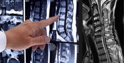 Diagnóstico de dolor de espalda